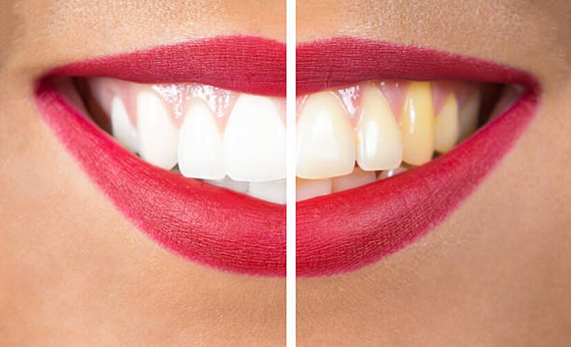 How a Cosmetic Dentist Can Help Improve Your Smile
