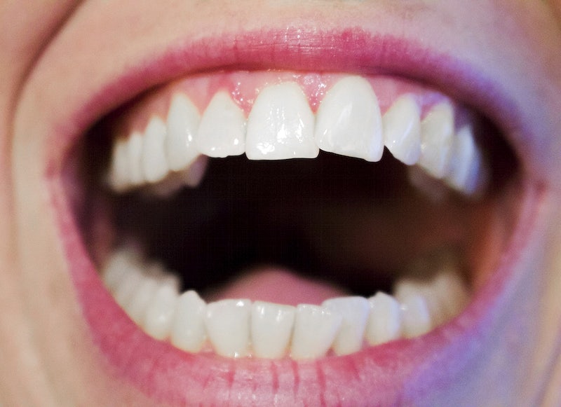 Things To Know About Teeth Whitening